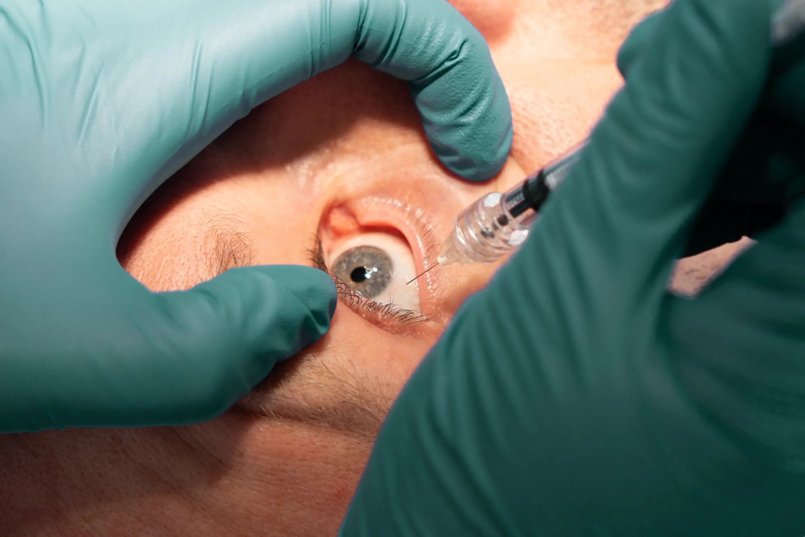 CLJ03190 (color corrected)